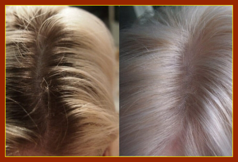 Обесцвечивание блонд волос средней длины